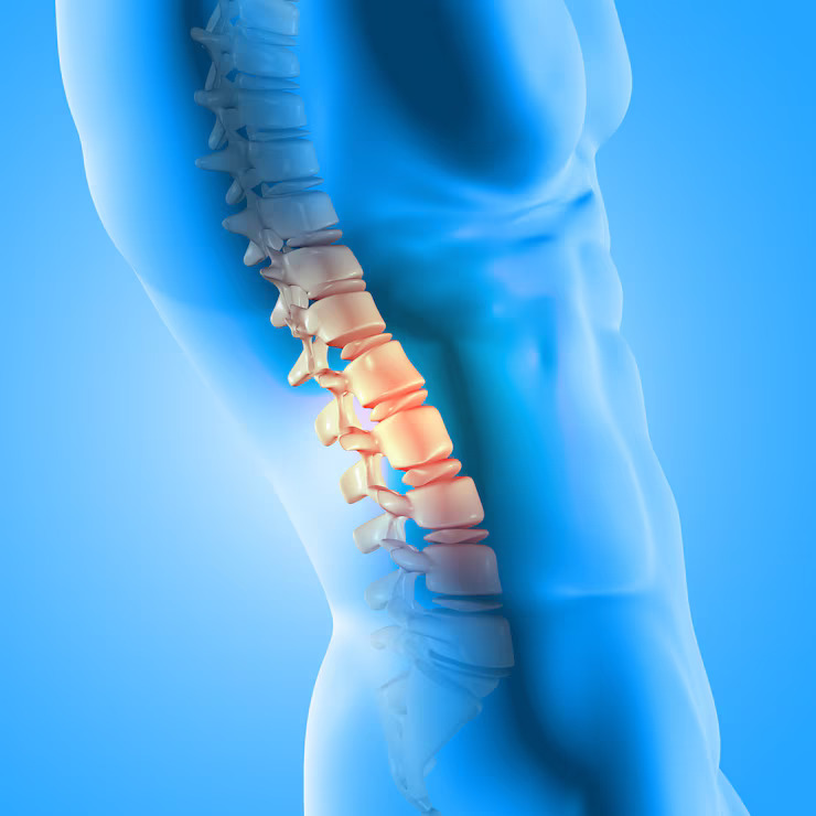 Understanding Different Types of Spine Surgery