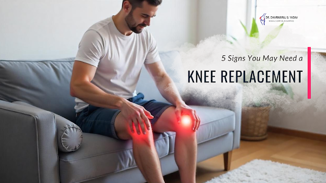 5 Signs You May Need a Knee Replacement