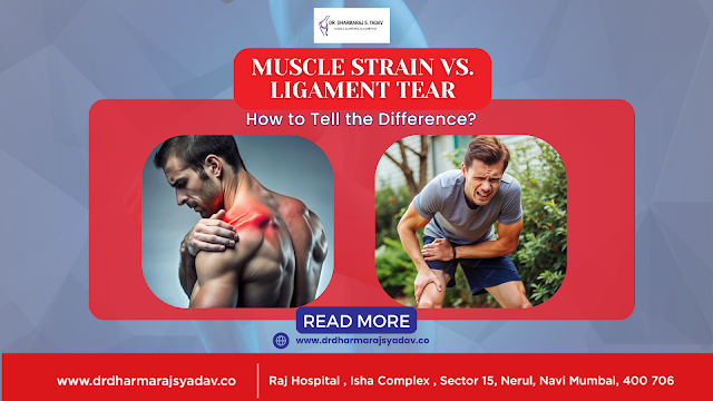 Muscle Strain vs. Ligament Tear: How to Tell the Difference