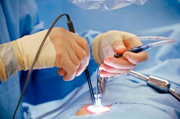 From Diagnosis to Recovery: Your Journey Through Spine Surgery with Our Team