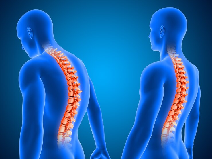 Slip Disc Causes: Common Factors Behind Spinal Disc Problems